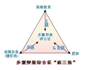 多囊性卵巢症并发症